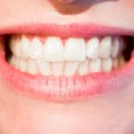 Przepiękne zdrowe zęby również powalający cudny uśmiech to powód do dumy.